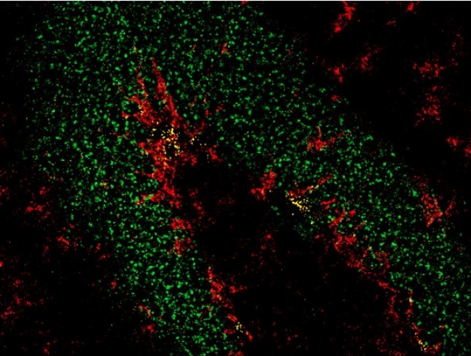 Elaboran un mapa molecular detallado del camino que sigue una célula madre del cerebro adulto hasta convertirse en una neurona madura