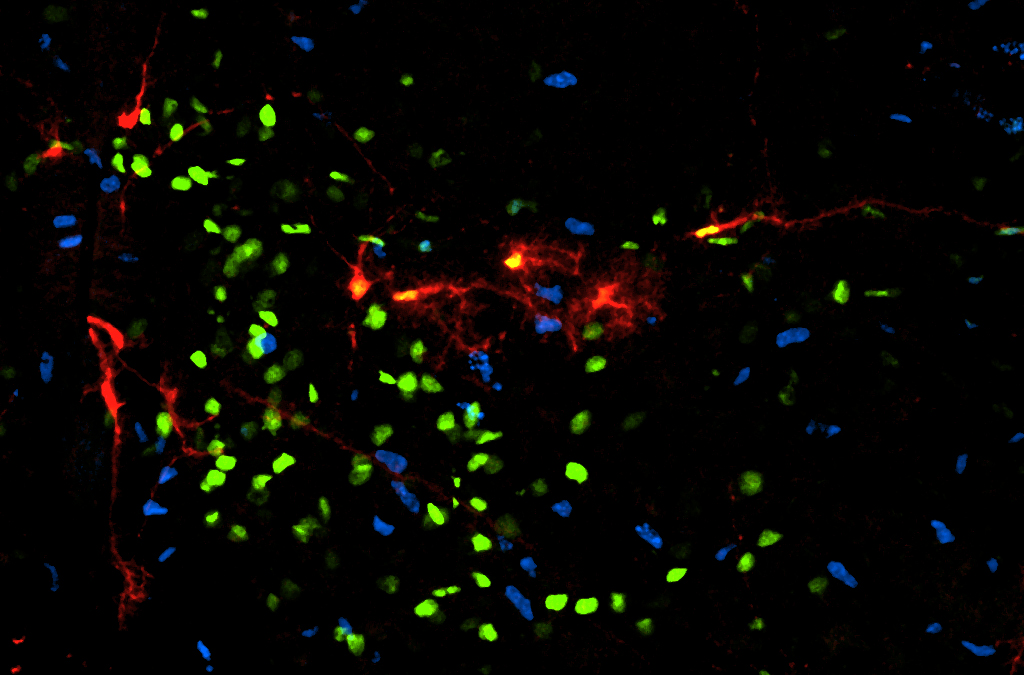 Determinan cómo se originan ciertas células del sistema nervioso central, claves para el funcionamiento de los circuitos neuronales